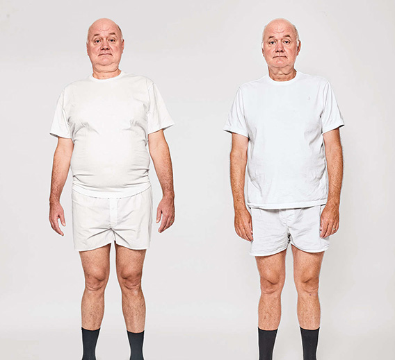 before-after-2